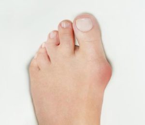 Blog Foot Pain 2
